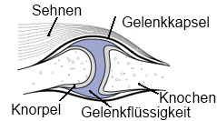 arthrose arthrose